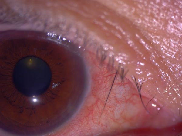 Dui mat khi ngua, nguoi phu nu gap chuyen ghe nguoi