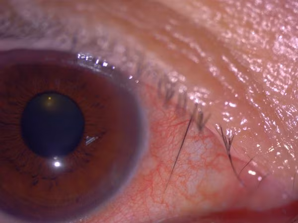 Dui mat khi ngua, nguoi phu nu gap chuyen ghe nguoi