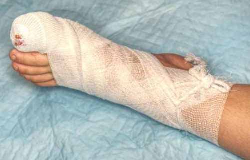 Lam dung khang sinh, nguoi dan ong suyt cut chi