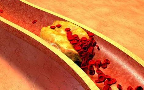 4 bat thuong o chan chung to huyet khoi hinh thanh