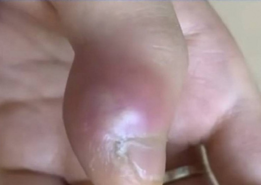 Nghien can mong tay, be trai suyt cut luon ngon