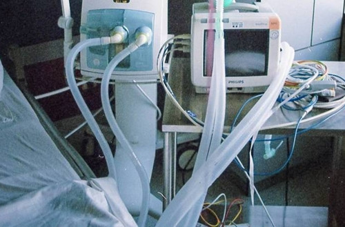 Tuong mac ung thu mau, hoa tri suot 18 thang va su that soc