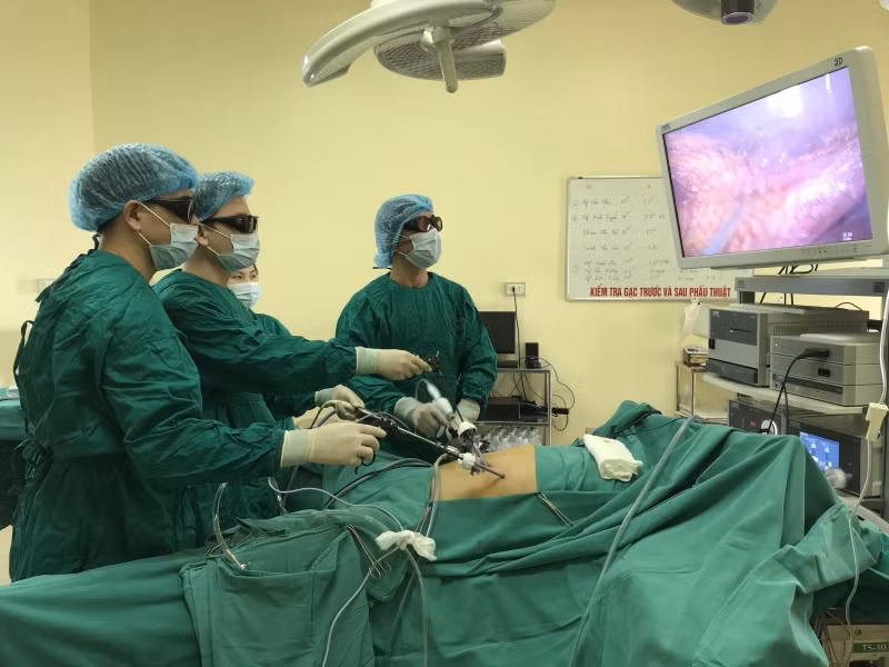 Bac si BV K chi ro doi tuong can canh giac voi ung thu tieu hoa-Hinh-2