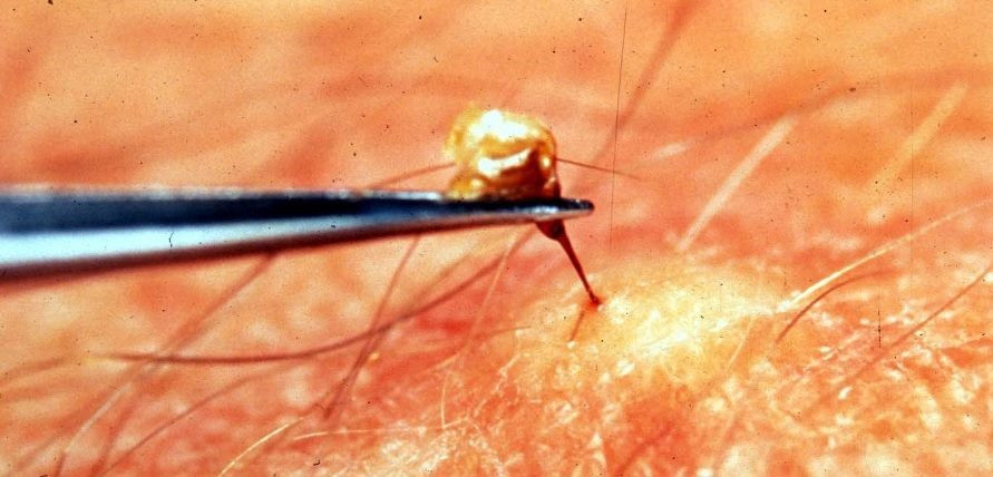 Khi bị loài vật đốt, đầu tiên hãy khều kim chích khỏi vùng bị đốt bằng vật nhọn như mũi dao, đầu kim... Không dùng tay nặn vì sẽ khiến nọc độc thấm sâu hơn vào cơ thể. Nếu bị ong vò vẽ đốt hoặc có biểu hiện của sốc phản vệ thì ngay lập tức phải đưa nạn nhân đến cơ sở y tế gần nhất để được cấp cứu kịp thời.