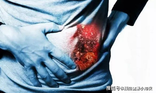 Ăn nhậu ban đêm. Sau ngày dài làm việc mệt mỏi, buổi tối là thời điểm gan bước vào giai đoạn nghỉ ngơi. Ăn tối đúng giờ là điều rất cần thiết. Vậy nhưng, bạn nên hạn chế ăn đêm bởi nó không có lợi cho sức khỏe gan, dễ gây ung thư gan. 