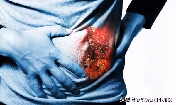 Ăn nhậu ban đêm. Sau ngày dài làm việc mệt mỏi, buổi tối là thời điểm gan bước vào giai đoạn nghỉ ngơi. Ăn tối đúng giờ là điều rất cần thiết. Vậy nhưng, bạn nên hạn chế ăn đêm bởi nó không có lợi cho sức khỏe gan, dễ gây ung thư gan. 