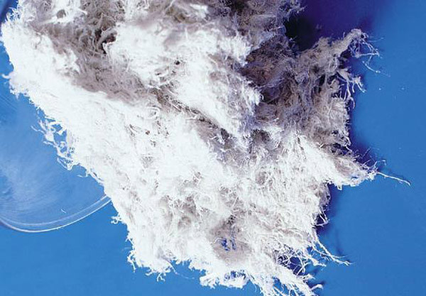 Điều nguy hiểm là một khi những sợi này vỡ ra, vô tình hít vào phổi, chúng sẽ mắc kẹt trong phổi. Nghiên cứu thực nghiệm trên người và động vật đều xác nhận amiăng có thể gây ung thư. Ảnh: Internet