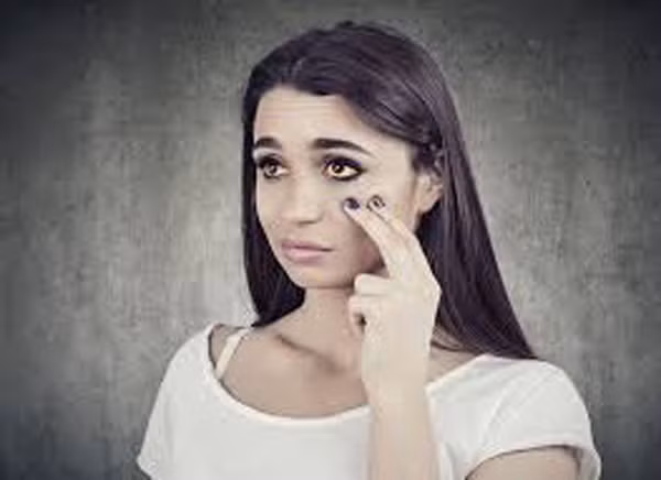 Như đã đề cập ở trên, gan đảm nhiệm nhiều vai trò trong đó có cân bằng nội tiết. Mắc chứng xơ gan, ung thư gan, chức năng gan suy giảm dẫn đến mất cân bằng nội tiết tố. Thời điểm này, cơ thể sinh lượng lớn melanin khiến da sẫm màu, môi và niêm mạc thâm đen, mắt có quầng.