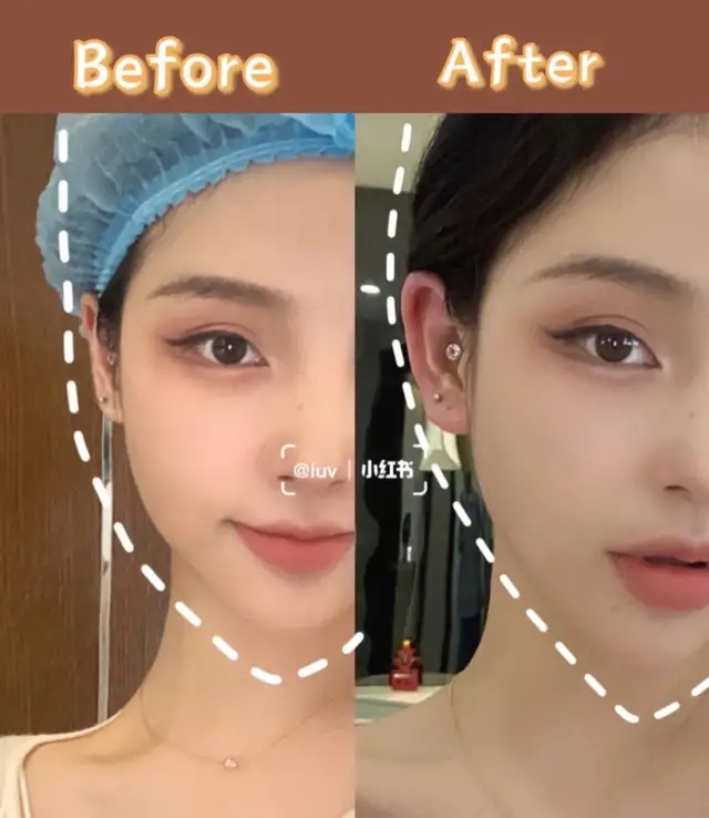 Vì vậy, bí quyết cho những ai muốn khuôn mặt bớt tròn trịa, hãy để lộ cả phần tai. Làm sao để trong những bức ảnh phần tai lộ ra càng nhiều càng tốt? Có 3 bí quyết đơn giản sau.