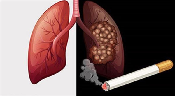 Đặc biệt, carbon monoxide là khí có hại mà người hút thuốc lá hít phải khi sử dụng thuốc. Khi đến phổi, khí này được chuyển vào đường máu trong cơ thể. Carbon monoxide làm giảm lượng oxy dùng để vận chuyển các tế bào hồng cầu. Nó còn làm tăng lượng cholesterol tích tụ ở thành trong của động mạch, khiến động mạch xơ cứng theo thời gian.