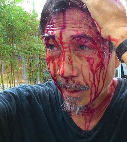 Bat khan cap 2 doi tuong truy sat dan chung cu Riverside Garden-Hinh-2