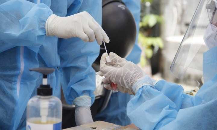 GD So Y te Dong Nai: Khong khuat tat khi mua kit test COVID-19 cua Viet A