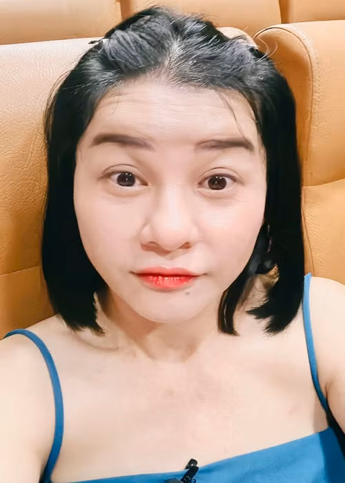 “Thương em Việt Hương, ngồi chờ chị Cát cắt mí xong, vào xem tận mắt rồi mới chịu. Bác sĩ canh rất khó vì mắt Cát bên lớn bên nhỏ, da không nhiều, mỡ mắt cũng không nhiều. Bác sĩ phải làm kỹ nếu không mắt sẽ rất dễ bị trợn”, Cát Phượng chia sẻ.