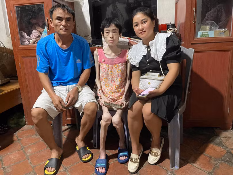 Nhieu nam khong an com giam can, co gai chi con da boc xuong-Hinh-2