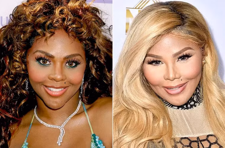 Khuôn mặt Lil’ Kim càng ngày càng sưng mọng và khi so ảnh trước kia và bây giờ của nữ rapper như hai con người hoàn toàn khác nhau. (Ảnh: AnandTech Forums)