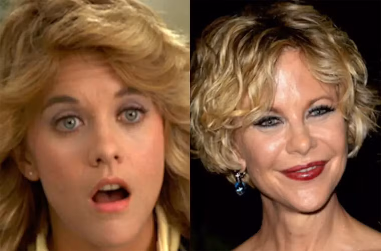 Meg Ryan là một trong những ngôi sao Hollywood thay đổi khuôn mặt nhiều nhất. Mặc dù không chịu công nhận nhưng chỉ nhìn ngôi sao "Không ngủ ở Seattle" ai cũng có thể nhận thấy cô lạm dụng Botox quá nhiều. (Ảnh: Famosos ao Minuto)