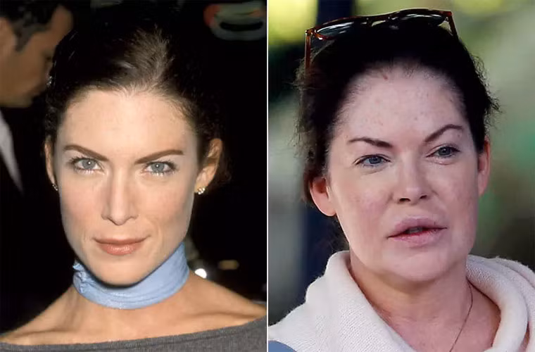 Kể từ khi ngoại hình thay đổi theo chiều hướng xấu đi, Lara Flynn Boyle đã không còn là ngôi sao nổi tiếng ở Hollywood nữa. (Ảnh: express.co.uk)