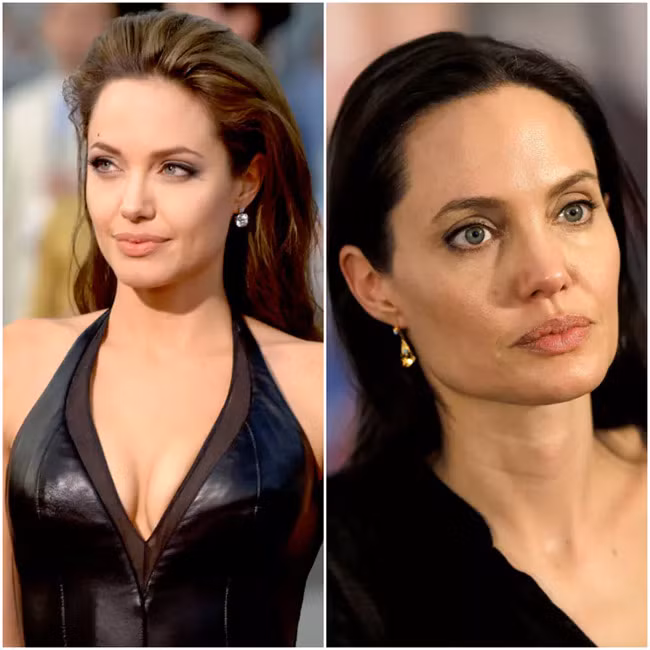 Nhan sắc của Angelina Jolie đã xuống dốc kể từ khi cô phẫu thuật đoạn nhũ vào năm 2013 và càng thảm hại hơn kể từ sau khi đệ đơn ly hôn Brad Pitt. Có tin cho hay, Jolie đã bị xuống cân trầm trọng và hiện chỉ nặng 35kg. (Ảnh: harpersbazaar.com, ibtimes.com)