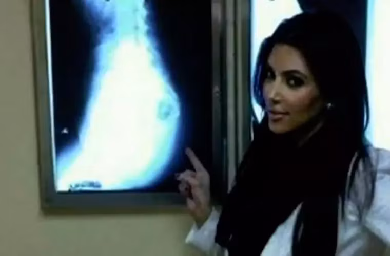 Năm 2011, Kim đã khoe trên chương trình Keeping up with the Kardashians tấm phim chụp X-quang để chứng minh cô không phẫu thuật độn mông. (Ảnh: movietvtechgeeks)