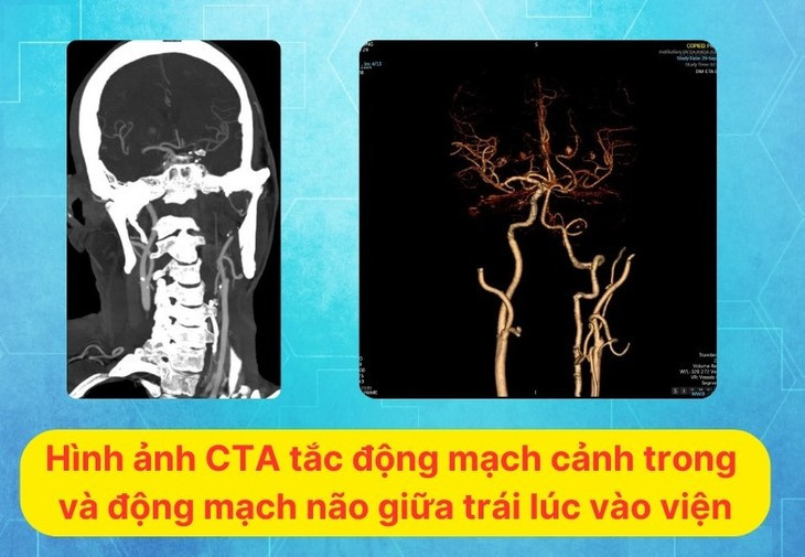 Dot nhien yeu nua nguoi, mat ngon ngu do nhoi mau nao