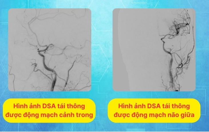 Dot nhien yeu nua nguoi, mat ngon ngu do nhoi mau nao-Hinh-2