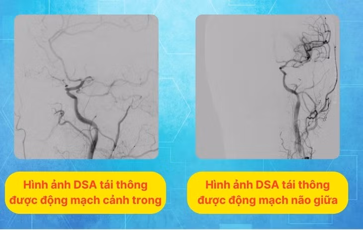Dot nhien yeu nua nguoi, mat ngon ngu do nhoi mau nao-Hinh-2