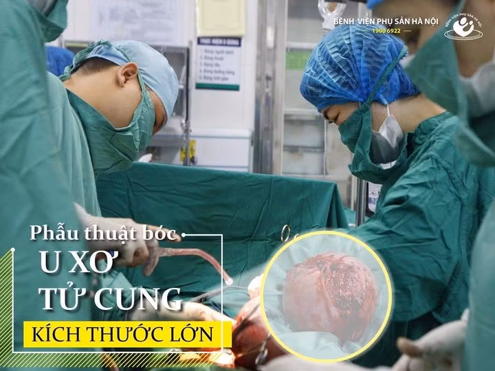 Phai cat tu cung vi chu quan de u 10 nam moi di kham