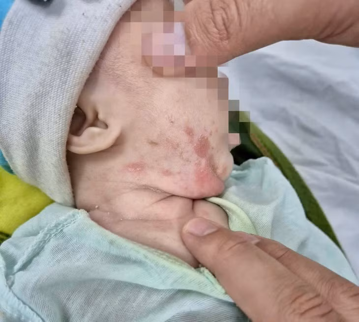 Be trai loet khap nguoi vi mac giang mai bam sinh-Hinh-2