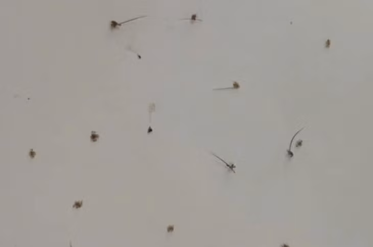 Phát hoảng rận bám chi chít trên mi mắt người phụ nữ 46 tuổi Phat hoang ran bam chi chit tren mi mat nguoi phu nu 46 tuoi