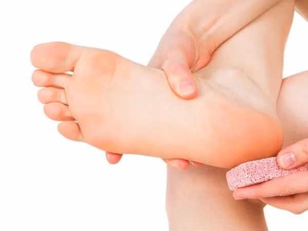 Meo cham soc got chan kho, nut ne trong mua dong-Hinh-2