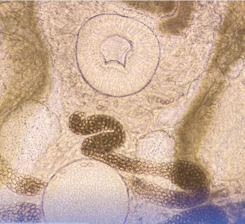 An ca chua nau chin, coi chung nhiem san la ruot nho