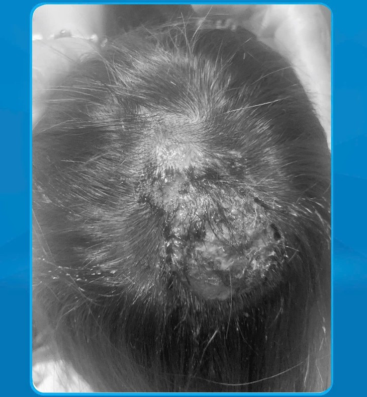 Be 7 tuoi hoai tu da dau do nam boi nhiem, cach phong tranh