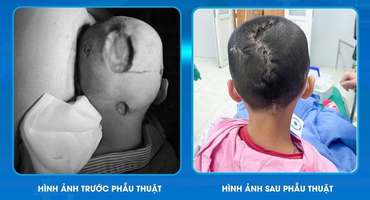 Be 7 tuoi hoai tu da dau do nam boi nhiem, cach phong tranh-Hinh-2