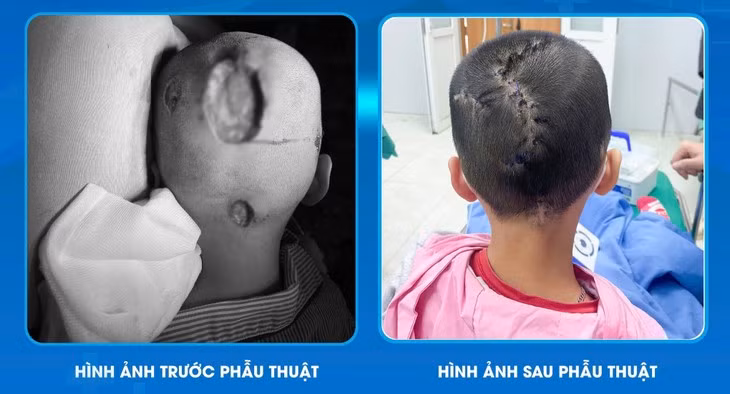 Be 7 tuoi hoai tu da dau do nam boi nhiem, cach phong tranh-Hinh-2