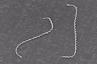 Suyt mat mang do nhiem Leptospira - hiem hoa tu chuot, ai de mac?-Hinh-2