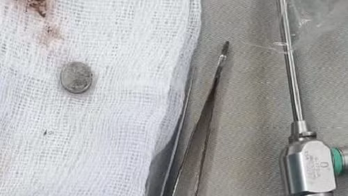 Gap thanh cong di vat trong mui be trai hon 3 tuoi