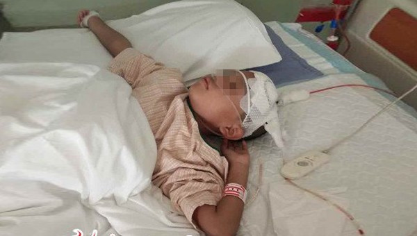 Cach phat hien dot quy o tre, cha me can luu tam-Hinh-2