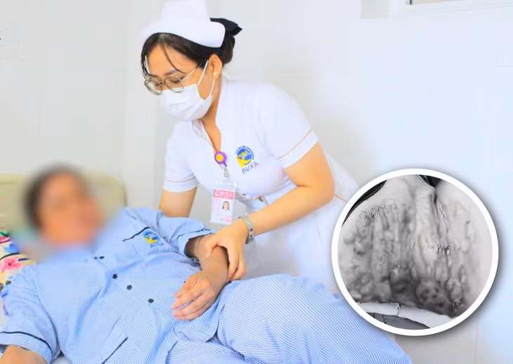 Nguoi phu nu bi bong nang vi gap su co khi giac hoi