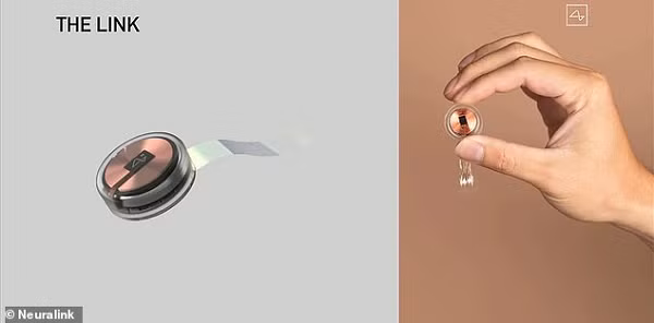 "Neuralink đang hoạt động hết sức chăm chỉ để bảo đảm an toàn khi cấy ghép và duy trì liên lạc chặt chẽ với Cục Quản lý Thực phẩm và Dược phẩm Mỹ (FDA). Nếu mọi chuyện ổn thỏa, chúng tôi có thể thử nghiệm sơ bộ trên người vào cuối năm nay", tỷ phú Mỹ Elon Musk viết trên Twitter hôm 3/2.