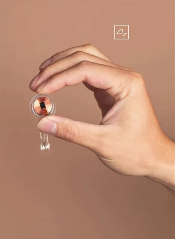 Elon Musk cho biết: “Chú khỉ không tỏ ra khó chịu hay có những hành động kỳ lạ. Thậm chí bạn không thể thấy thiết bị được cấy ghép trong hệ thần kinh của nó”.