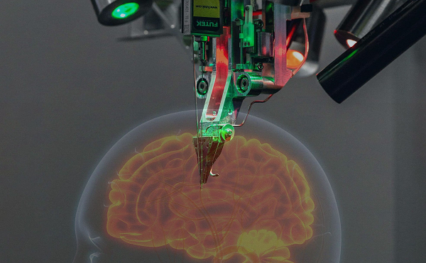 Phát biểu được đưa ra sau khi một người dùng Twitter có tên Hamoon Kamai tỏ ý sẵn sàng tham gia nghiên cứu lâm sàng của Neuralink. Kami gặp tai nạn xe hơi cách đây 20 năm và bị liệt từ vai trở xuống kể từ đó.