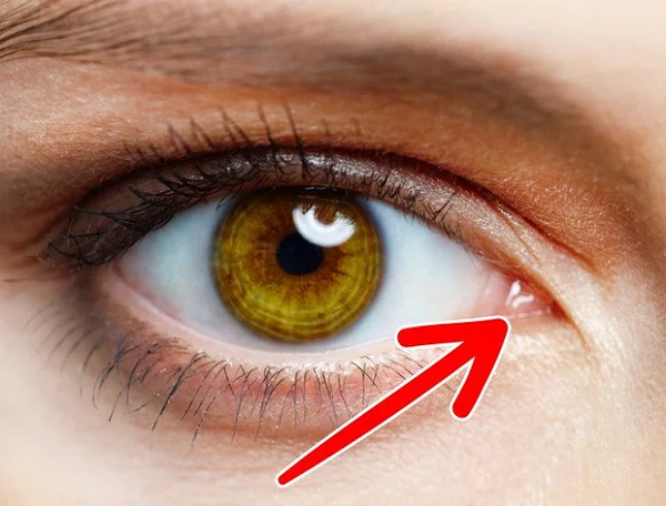 Tổ tiên chung của loài chim và động vật có vú xa xưa sở hữu 1 mí mắt thứ 3. Theo thời gian, mí mắt thứ 3 ở người bị vô hiệu hóa, chỉ còn lại dấu tích nhỏ và nó trở thành cơ quan vô dụng. Giới chuyên gia cho rằng, dần dần mí mắt thứ 3 này cũng hoàn toàn biến mất.