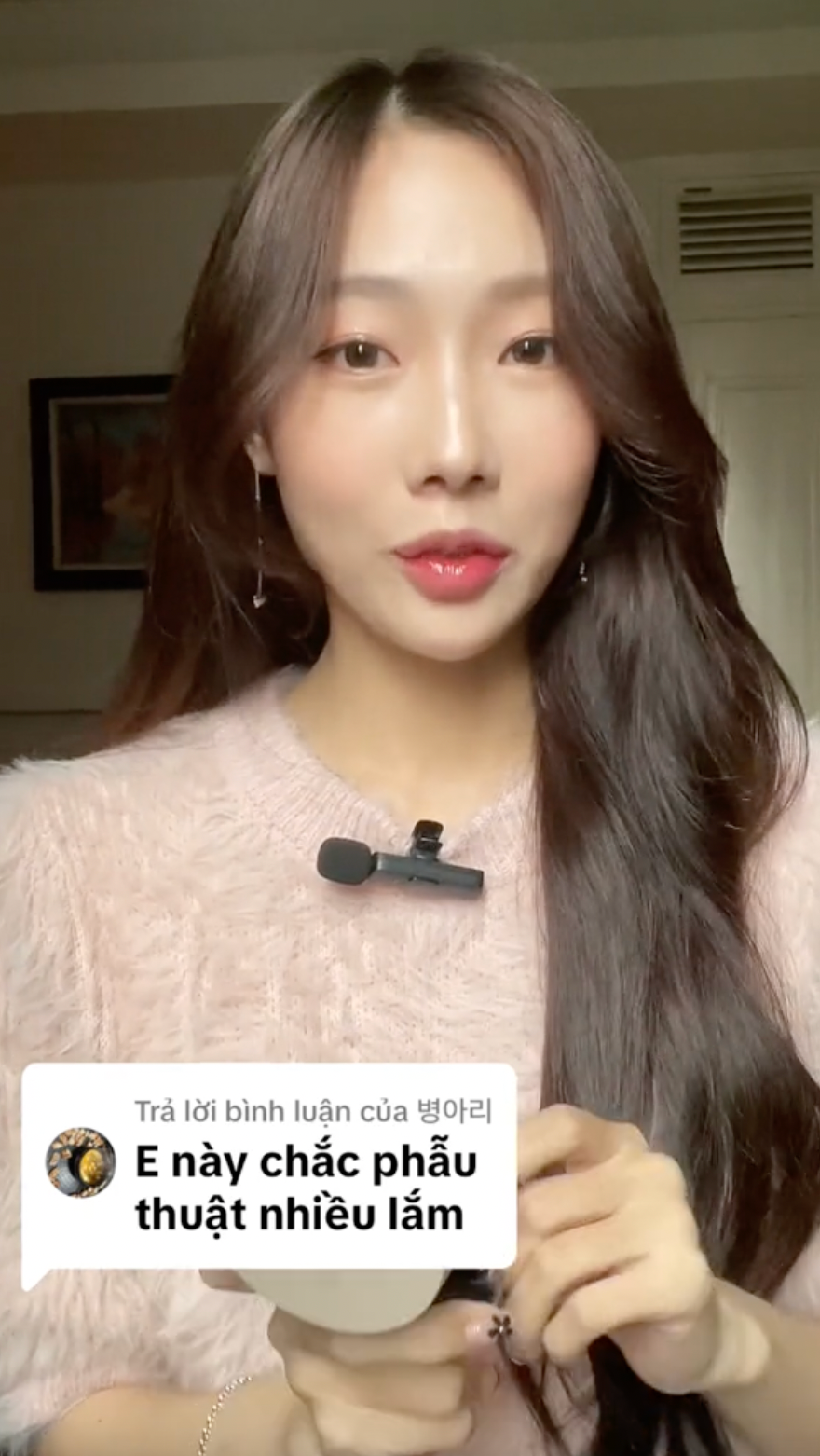 Trước những ý kiến trái chiều về nhan sắc của mình, Yuna Vũ phải liên tục lên tiếng giải thích. Cô khẳng định mình chỉ niềng răng, tiêm filler môi và cằm, còn lại thì không sửa mũi hay bất cứ điểm nào khác trên gương mặt.