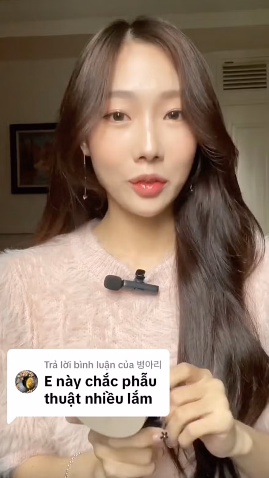 Trước những ý kiến trái chiều về nhan sắc của mình, Yuna Vũ phải liên tục lên tiếng giải thích. Cô khẳng định mình chỉ niềng răng, tiêm filler môi và cằm, còn lại thì không sửa mũi hay bất cứ điểm nào khác trên gương mặt.