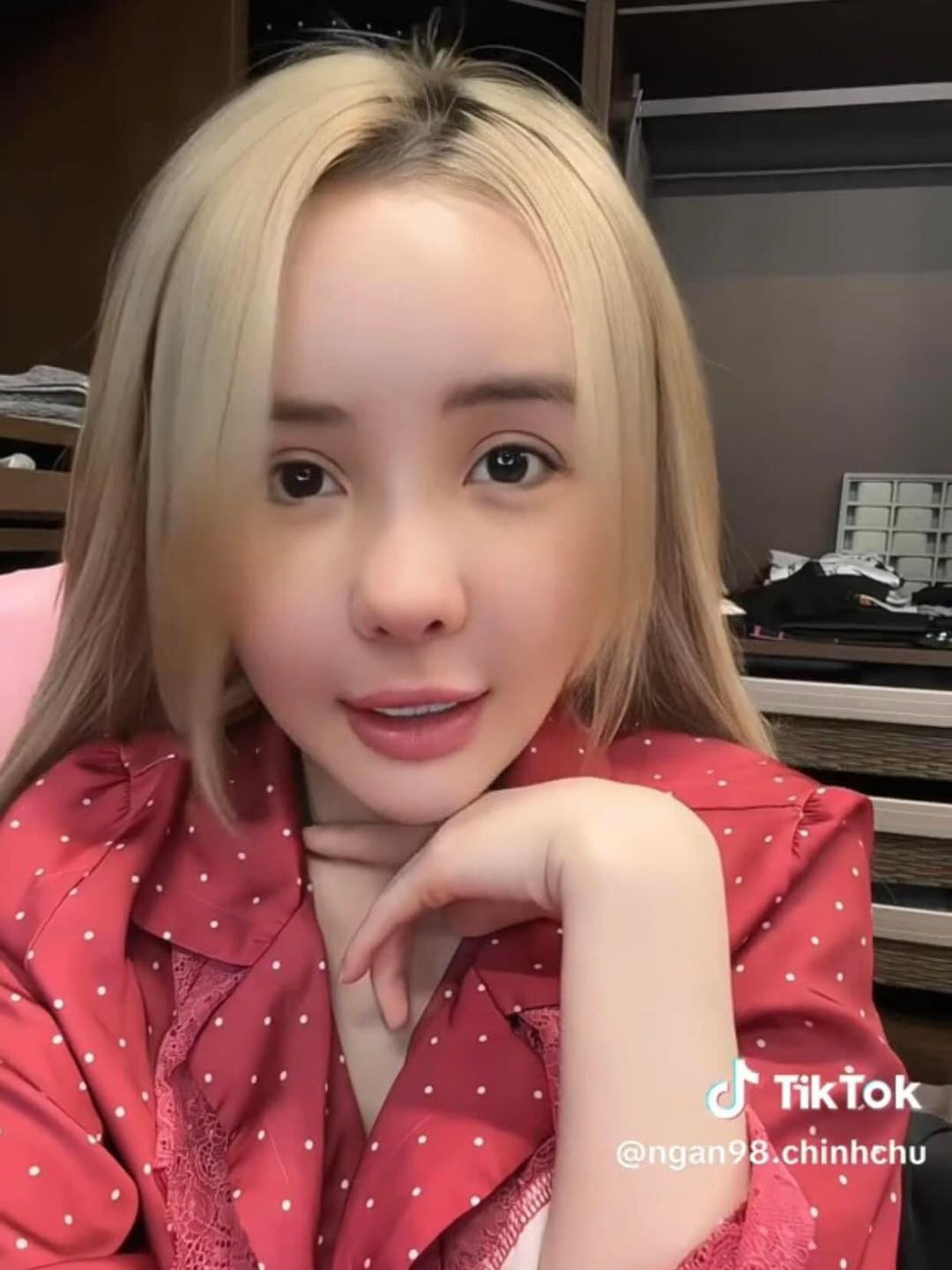 Về việc thoải mái công khai chia sẻ chuyện "dao kéo", cô từng tiết lộ lý do: "Tôi luôn thích chia sẻ mọi thứ về mình cho mọi người biết. Mọi thứ tôi chia sẻ đều là những gì tôi trải nghiệm trong cuộc sống của chính mình".