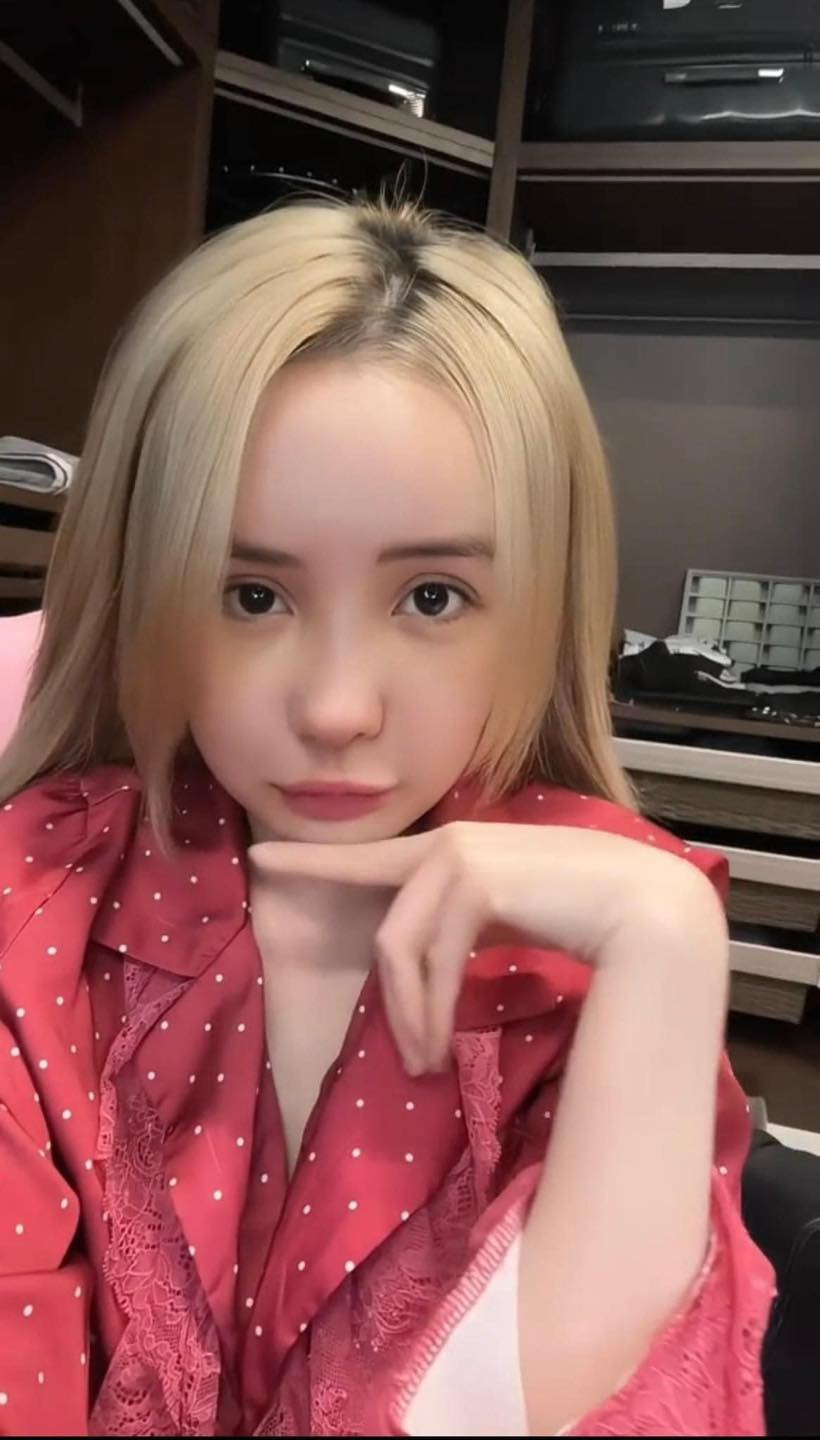 Sau khoảng 5 ngày chia sẻ việc đi "dao kéo", Ngân 98 đã chính thức lộ diện trên sóng livestream. Ở thời điểm hiện tại, dù các nét trên gương mặt vẫn còn sưng phù, nhưng cô nàng đã có thể thoải mái nói chuyện, trao đổi cùng người xem trực tiếp.