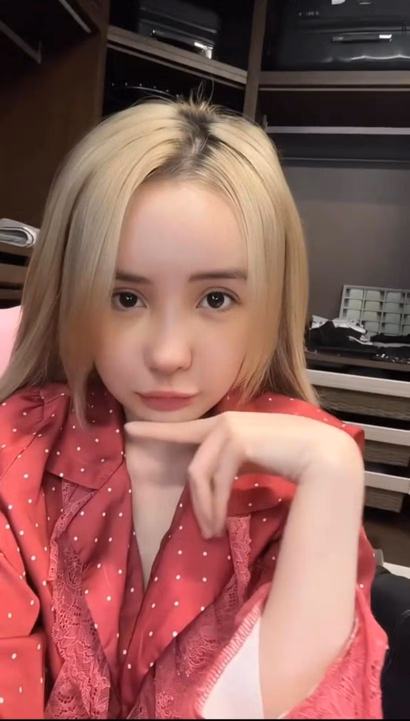 Sau khoảng 5 ngày chia sẻ việc đi "dao kéo", Ngân 98 đã chính thức lộ diện trên sóng livestream. Ở thời điểm hiện tại, dù các nét trên gương mặt vẫn còn sưng phù, nhưng cô nàng đã có thể thoải mái nói chuyện, trao đổi cùng người xem trực tiếp.