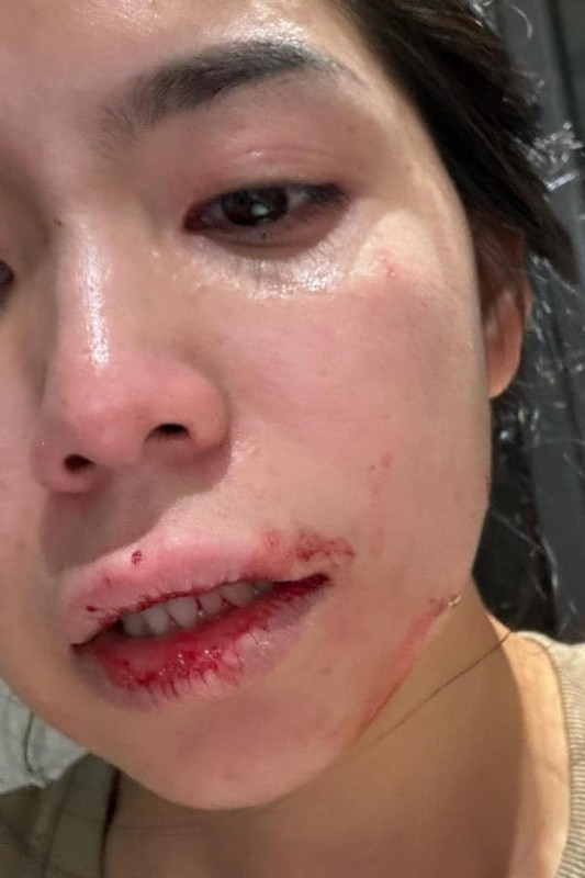 Vừa qua, trên trang cá nhân, Hằng Du Mục đã lên tiếng về vụ việc bị chồng bạo hành. Cô nàng đăng tải video cảnh người chồng bị cảnh sát khống chế, cùng với hình ảnh gương mặt đầy những vết thương.