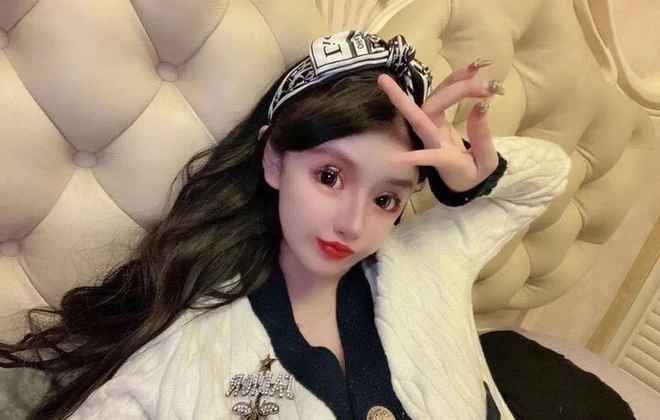 Zhou Chuna cũng tiếc nuối vì đã phá bỏ đường nét tự nhiên, tươi trẻ vốn có. Giờ đây, không ai nghĩ Zhou Chuna mới chỉ 19 tuổi mà cô vẫn phải tiếp tục phẫu thuật để chỉnh sửa lại những di chứng hậu thẩm mỹ cho gương mặt hài hòa hơn.