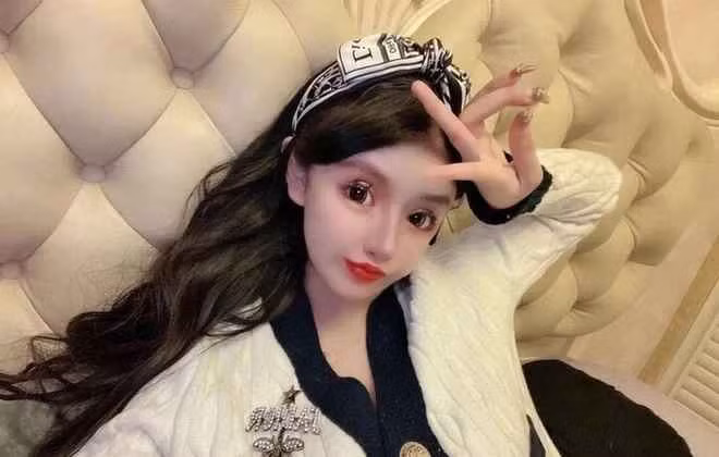 Zhou Chuna cũng tiếc nuối vì đã phá bỏ đường nét tự nhiên, tươi trẻ vốn có. Giờ đây, không ai nghĩ Zhou Chuna mới chỉ 19 tuổi mà cô vẫn phải tiếp tục phẫu thuật để chỉnh sửa lại những di chứng hậu thẩm mỹ cho gương mặt hài hòa hơn.